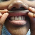 A smiley piercing with assisted demonstration