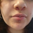 A freshly done vertical labret