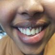 A happy customer with a smiley piercing