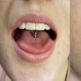 A tongue piercing