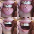 A smiley and a tongue piercing done at the same time