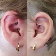 Daith piercing in both ears