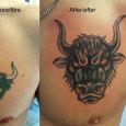 The sign of the ox made larger on top of an old tattoo