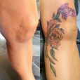 Flowers covering a scar by the knee