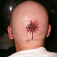 A bullet wound on the back of the head
